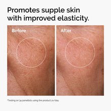 Before and after showing improved skin elasticity with twice daily use.